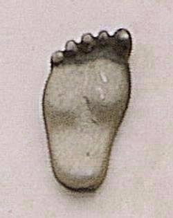 Chubby Foot